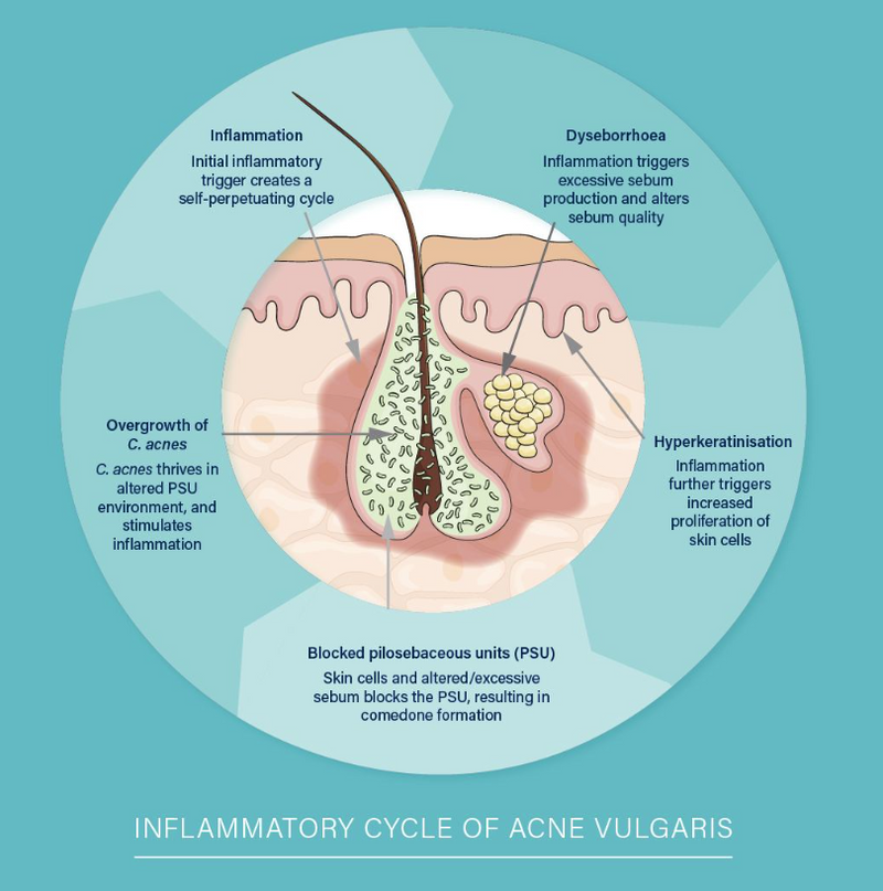 Biome Acne Probiotic 30 caps